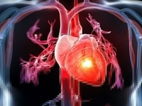 Vì sao bệnh nhân tim mạch phải phòng bệnh truyền nhiễm?