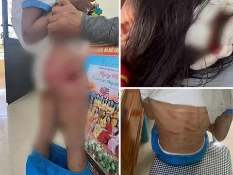 Bạo hành trẻ em: Vết thương từ gia đình và rào cản pháp lý