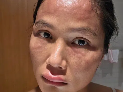 Lý do H'Hen Niê gây lo lắng