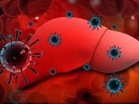 Dấu hiệu nhận biết viêm gan B giai đoạn sớm