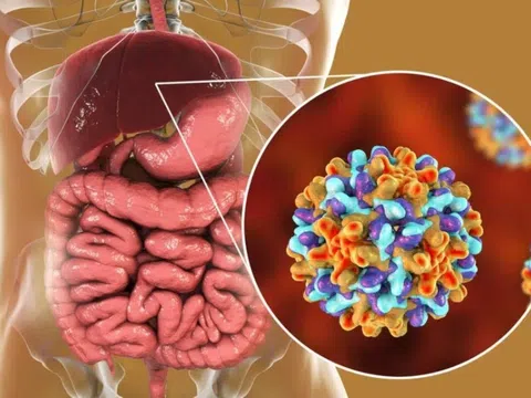 Dấu hiệu cảnh báo viêm gan B giai đoạn đầu