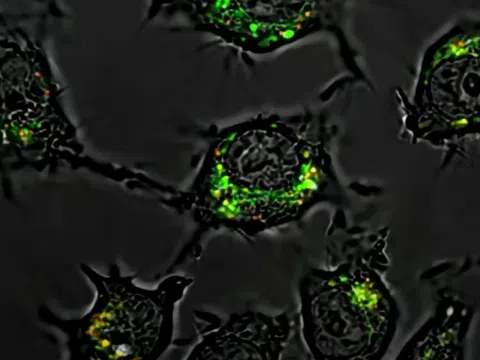 Phát hiện thuốc mới giúp tiêu diệt tế bào ung thư mạnh gấp 20.000 lần