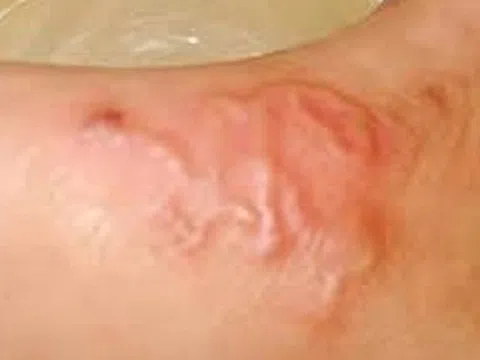 Hàng nghìn người ở Khánh Hòa mắc căn bệnh từ chó, mèo