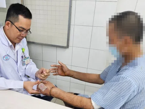 Người đàn ông 40 tuổi nhập viện với đôi tay đứt lìa