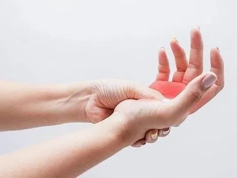 Tê tay chân liên tục, cảnh giác bệnh nguy hiểm hiếm gặp