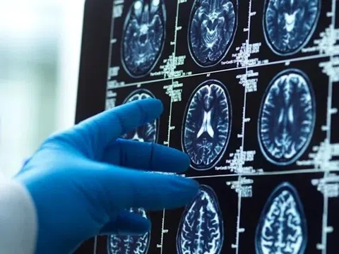 Phim chụp não người khiến nhà khoa học sửng sốt