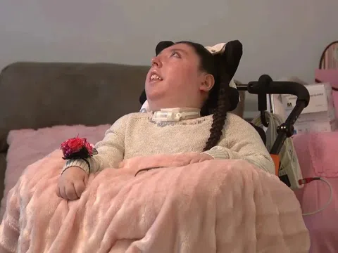 Cuộc sống hiện tại của cô gái không có não