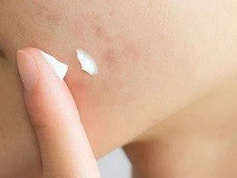 Thu hồi 46 loại mỹ phẩm trên toàn quốc