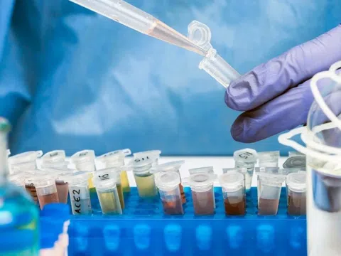 Loại virus hoang dại trở lại Châu Âu sau hàng chục năm, WHO cảnh báo