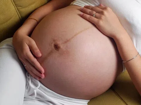 Vì sao người Việt chọn sinh mổ ngày một nhiều?