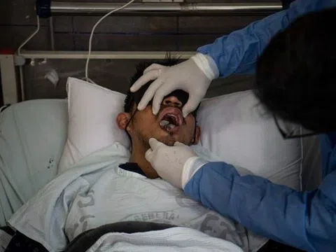 Loài virus gây tỷ lệ mất mạng đến 80% lại bùng phát