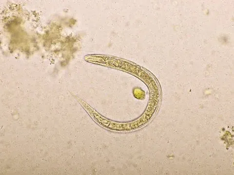 Khó thở và ho nhiều, đi khám bác sĩ phát hiện lý do không ngờ