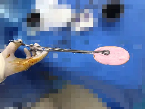 Bé gái 12 tuổi nhập viện với vùng kín chảy máu