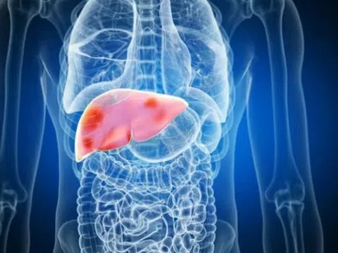 Những thói quen hại gan vào buổi sáng nhiều người dễ mắc phải