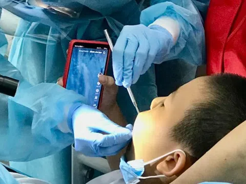 Bác sĩ cảnh báo những đồ ăn dễ gây mòn răng