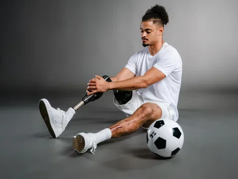 Cầu thủ cắt bỏ chân ở tuổi 17 do não mô cầu và lời cảnh tỉnh giới trẻ