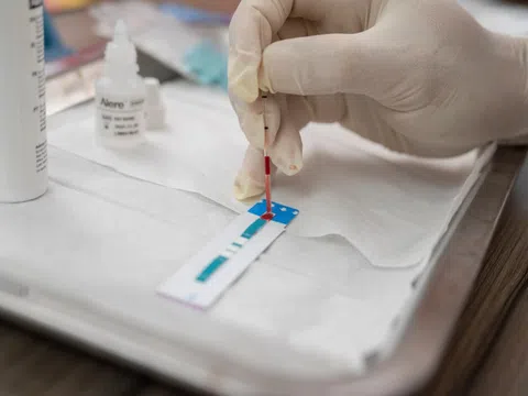 Đường lây truyền thay đổi, HIV tại Việt Nam trở nên nguy hiểm hơn