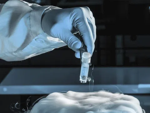 Người hiến tinh trùng mang gene ung thư làm cha của gần 200 đứa trẻ