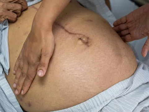 Lý do đàn ông Việt hay mắc bệnh gan