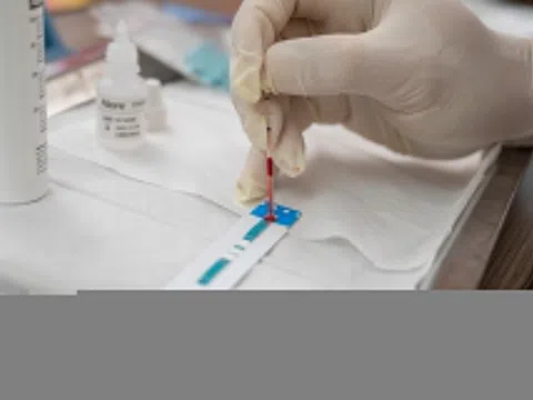 Một nước Đông Nam Á ghi nhận hàng chục ca nhiễm HIV mỗi ngày