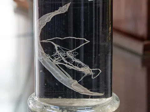 'Sát thủ' ẩn nấp trong cơ thể, âm thầm phá hoại gan, não