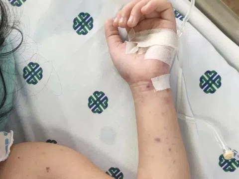 Căn bệnh để lại di chứng suốt đời ngay cả khi được cứu sống kịp thời