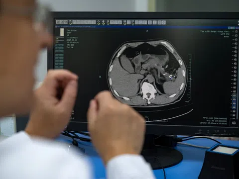 Trung Quốc quyết liệt đưa AI vào chẩn đoán bệnh, những câu hỏi đặt ra