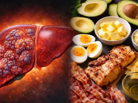 Ăn nhiều chất béo, giảm tinh bột có 'nuôi' ung thư gan?