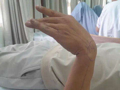 Người đàn ông gánh hậu quả không ngờ chỉ sau 30 phút ngủ gật