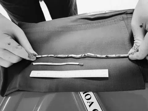 Bắt chước trên mạng, nam sinh 15 tuổi cấp cứu vì 'cậu nhỏ' đau dữ dội