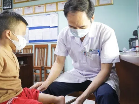 Xoay cẳng chân 180 độ, bác sĩ Việt tạo 'khớp gối mới' cho bé trai 5 tuổi