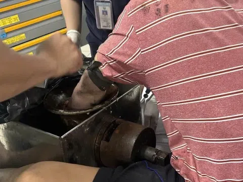 Người đàn ông mang máy xay thịt vào khoa cấp cứu ở TP.HCM