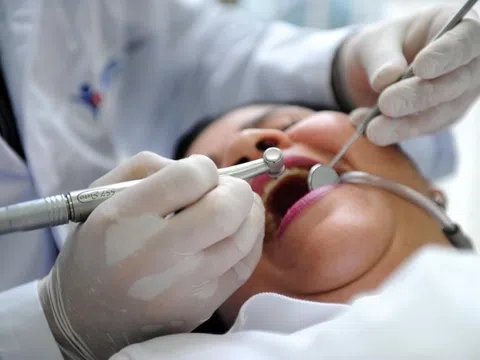 Hối hận sau khi làm răng sứ