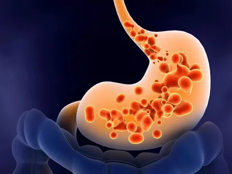 Căn bệnh ngày càng nhiều nam giới mắc, nguy cơ ung thư cao