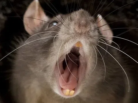 Thiếu niên 16 tuổi mắc bệnh hiếm sau 1 tháng bị chuột cắn