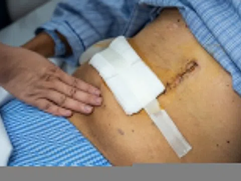 Người đàn ông phát hiện ung thư từ 2 triệu chứng không ai ngờ