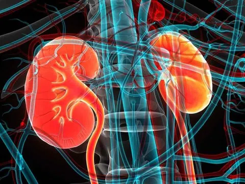 Bệnh suy thận mạn tính: Bác sĩ nêu 8 triệu chứng điển hình