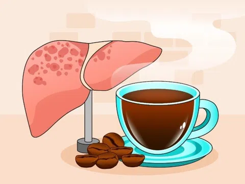 Một loại đồ uống quen thuộc hỗ trợ cải thiện gan nhiễm mỡ