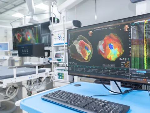 Bệnh viện Chợ Rẫy có hệ thống thông tim hiện đại nhất phía Nam