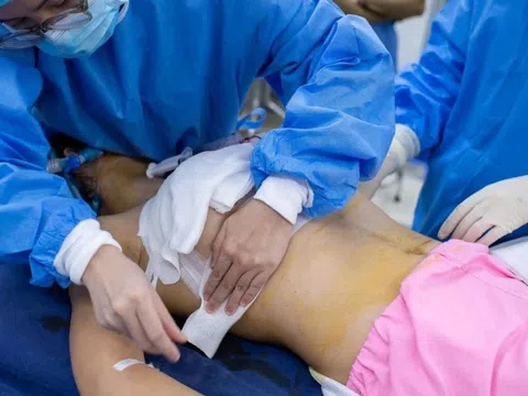 Cận Tết đi thẩm mỹ: Điều bác sĩ muốn bạn biết