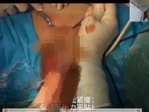 Bệnh viện Trung Quốc gây phẫn nộ vì livestream lộ vùng kín bệnh nhân