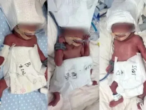 Sản phụ 24 tuổi sinh 5, tỷ lệ 1/60 triệu ca