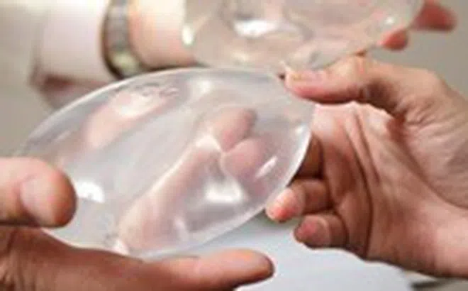 Đặt túi ngực ‘bảo hành trọn đời’, được 4 năm đã vỡ lúc nào không biết