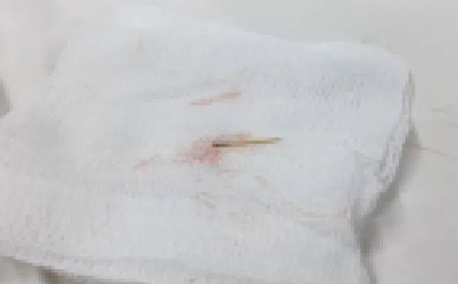 'Thủ phạm' không ngờ khiến người phụ nữ đau bụng liên tục