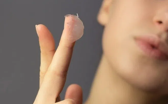 Bộ Y tế yêu cầu thu hồi, tiêu hủy một lô sáp nẻ Vaseline