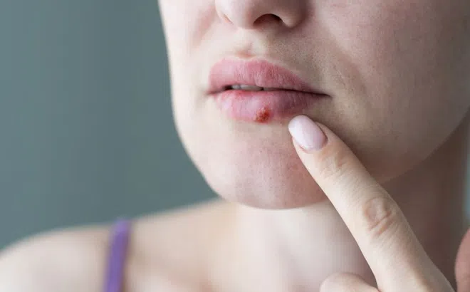 Dấu hiệu trên mặt cảnh báo bất thường, cần đi khám ngay