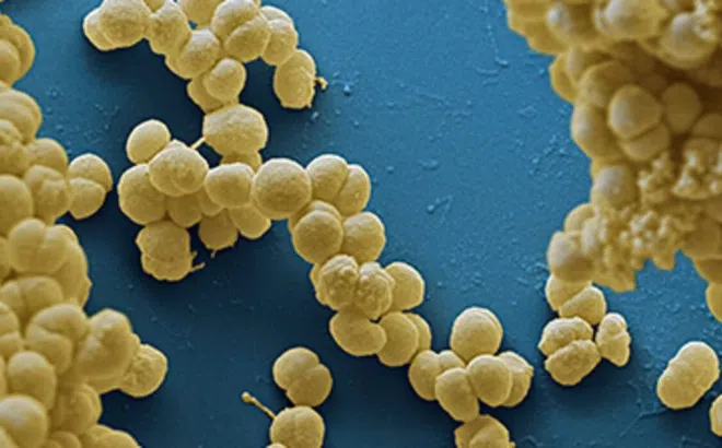 Bệnh não mô cầu lây lan ở Bắc Kạn, Bộ Y tế chỉ đạo khẩn