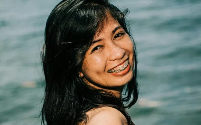 Chiêu 'săn' khách niềng răng của các cơ sở nha khoa