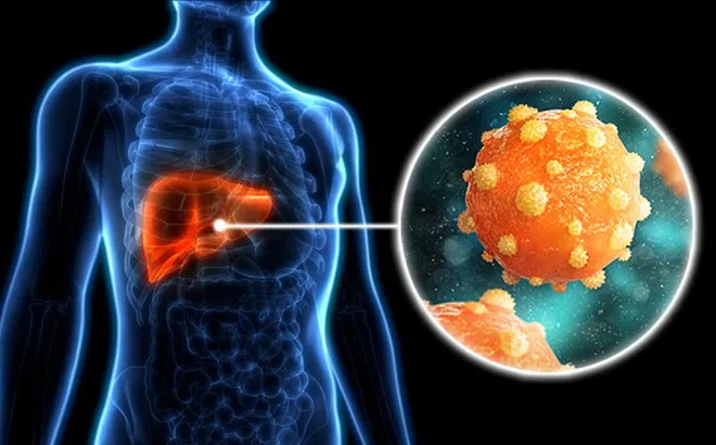 Chế độ ăn người bệnh viêm gan B cần biết