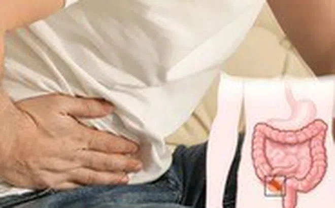 Đau bụng bất thường, cẩn trọng viêm ruột thừa cấp